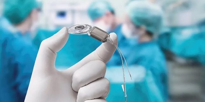 Realizaron REALIZARON OPERACIONES DE IMPLANTES COCLEARES EN LA CHET GRACIAS A LA ...